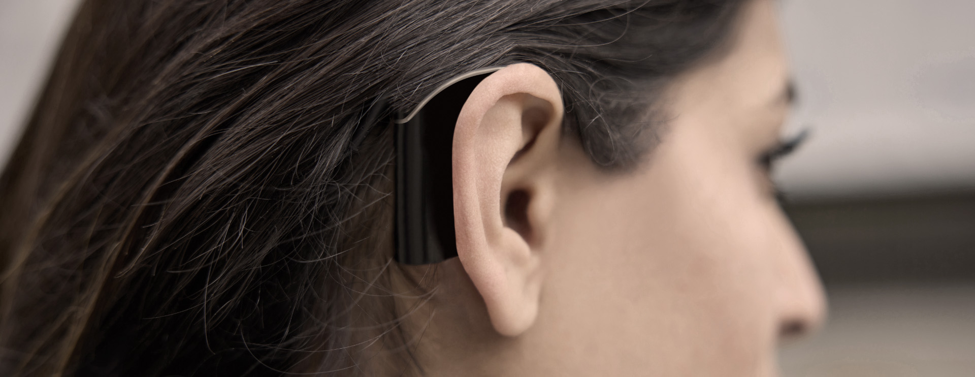 cochlear-implants-monaco